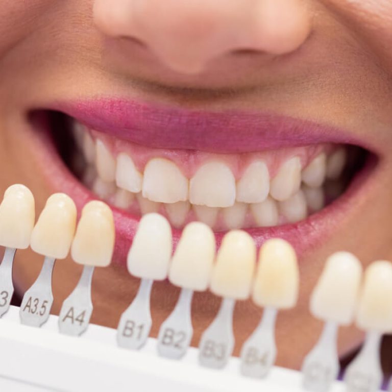 whitening